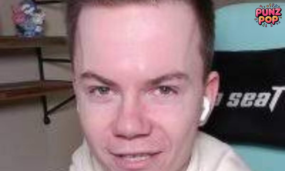 Big Forehead Nicknames 😂💀